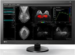 Eizo RadiForce RX840-MG